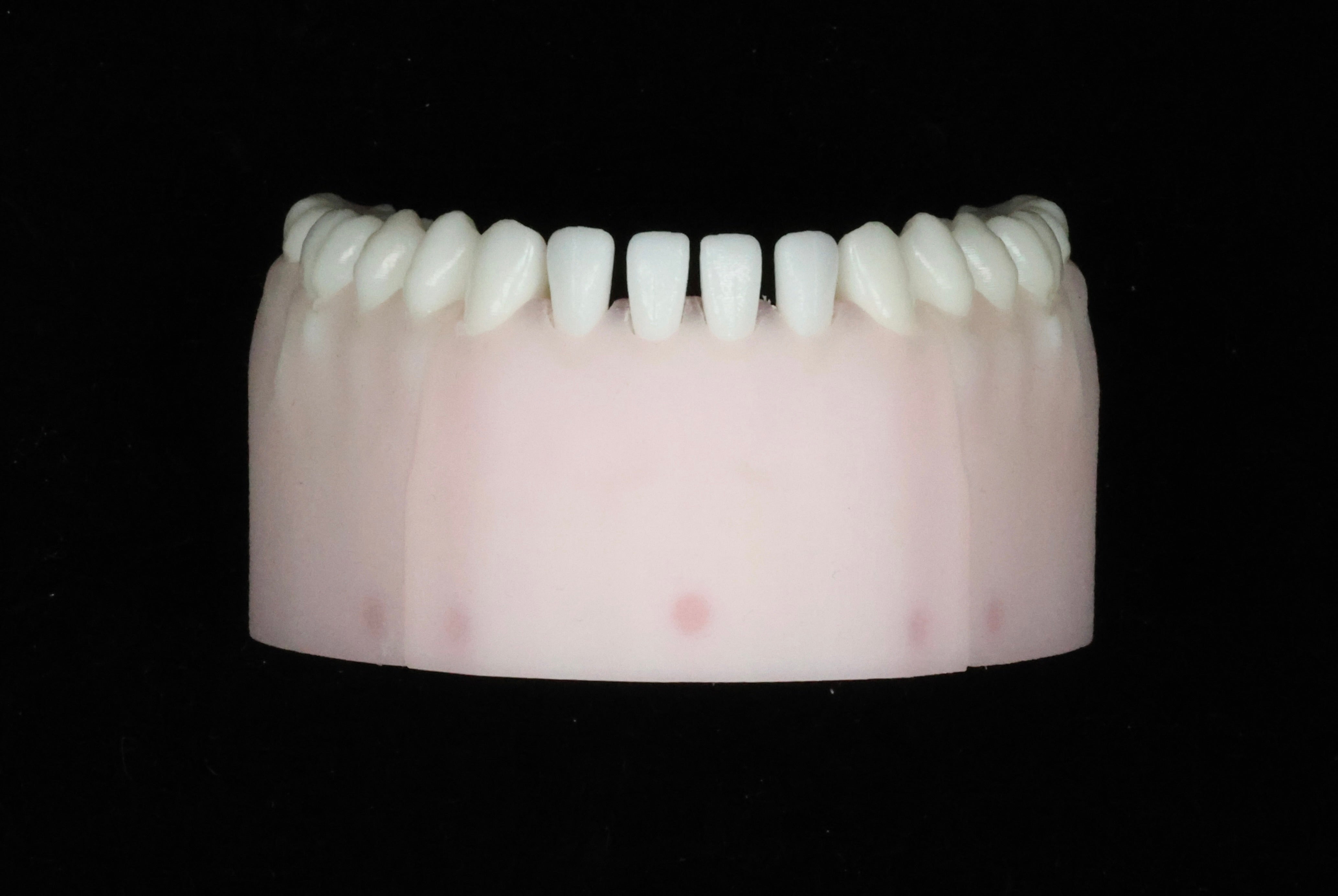 Spaced Teeth Set