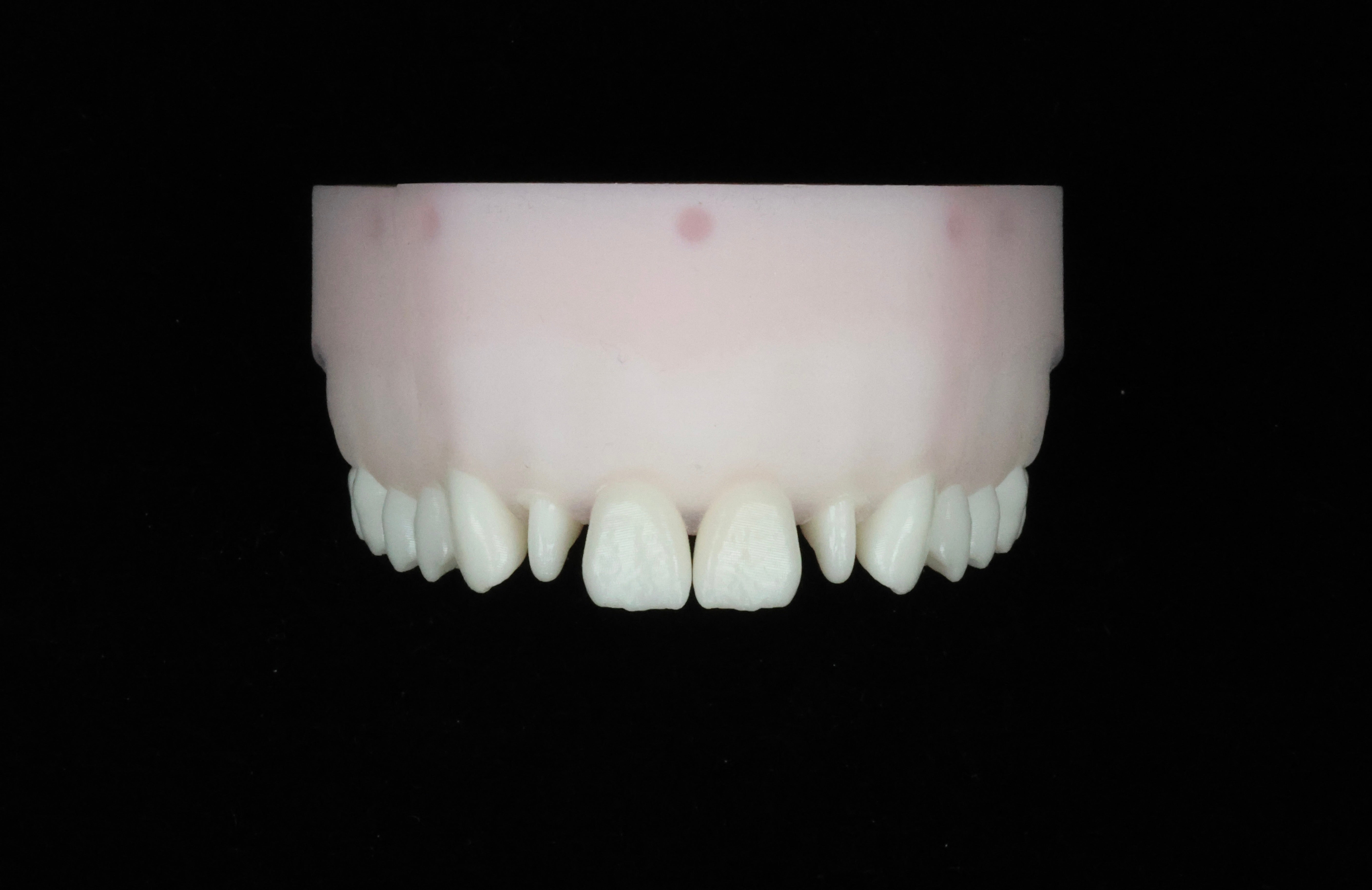 Peg Lateral Set