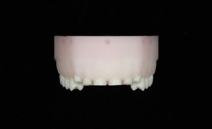 Severe Toothwear Set