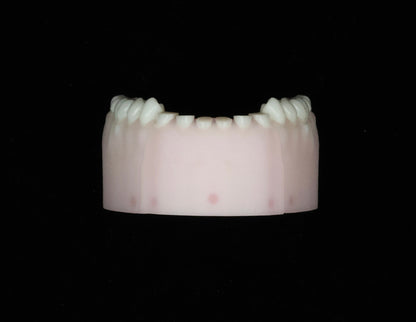 Severe Toothwear Set