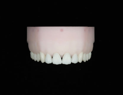 Black Triangle Closure/Reduction Set
