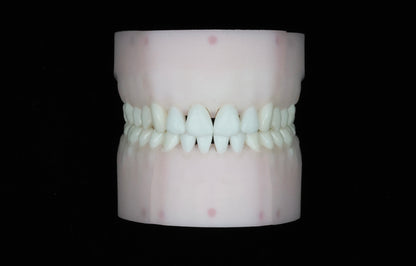 Black Triangle Closure/Reduction Set