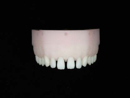 Spaced Teeth Set
