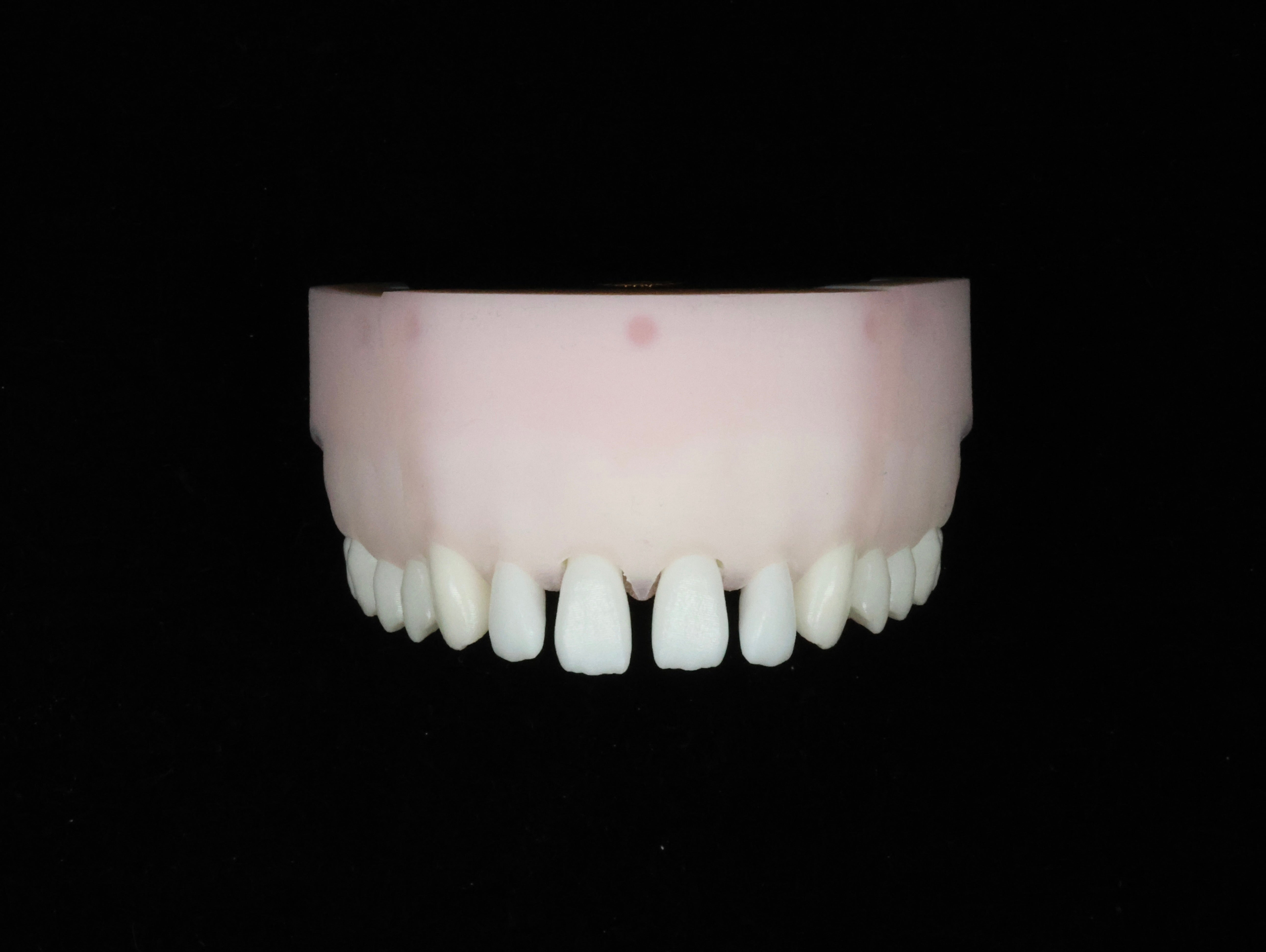 Spaced Teeth Set