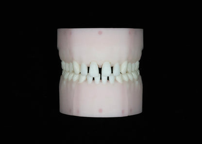 Spaced Teeth Set