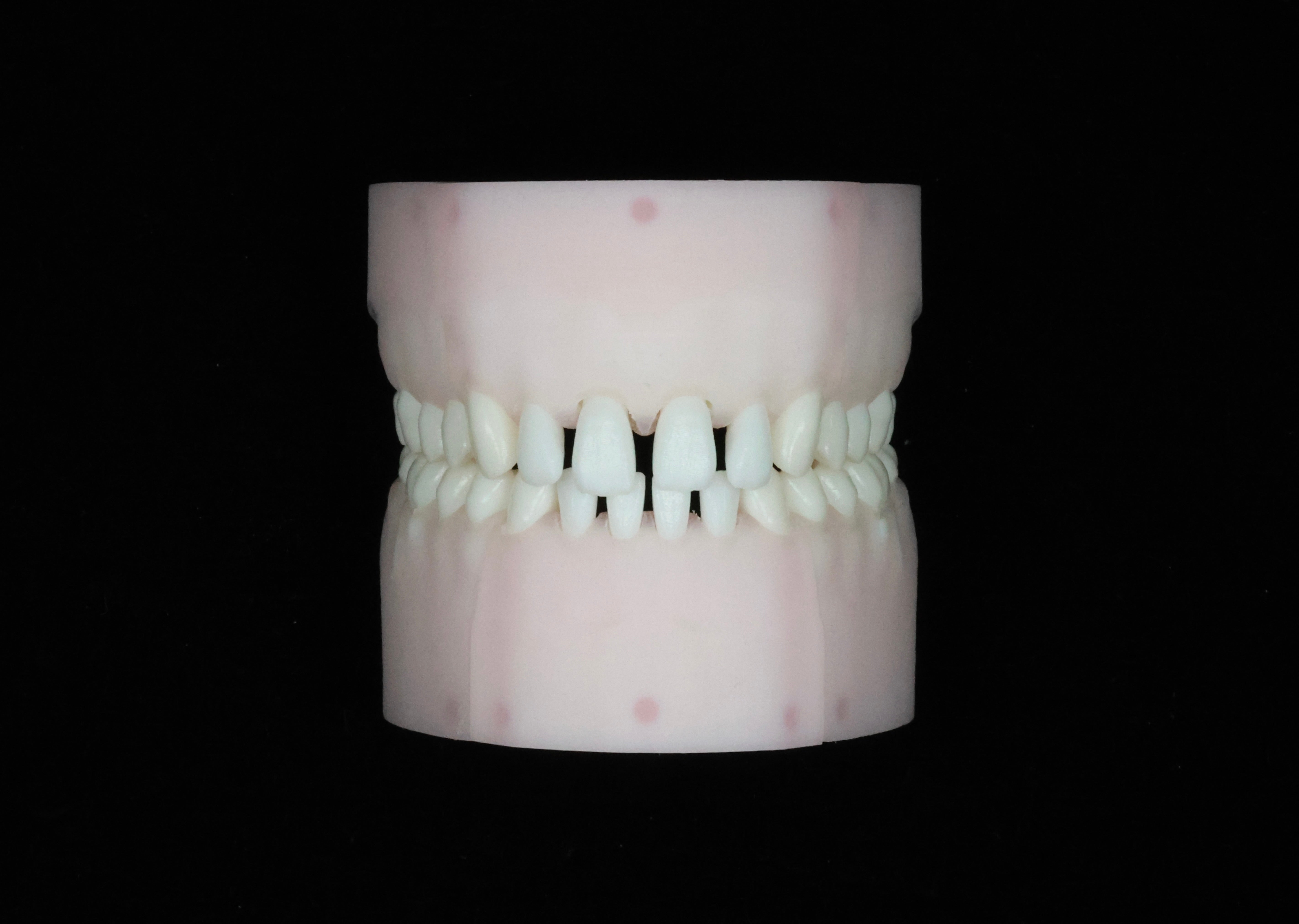 Spaced Teeth Set