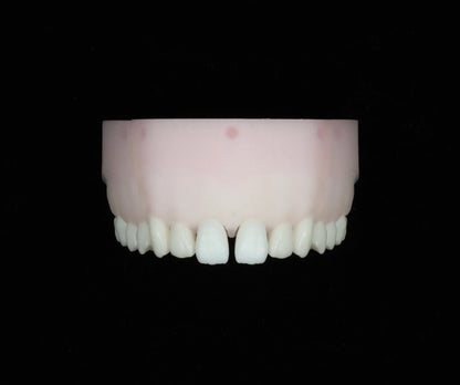 Diastema Closure Set