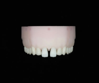 Diastema Closure Set