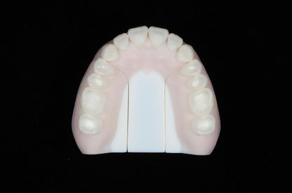 Class One Cavities Set