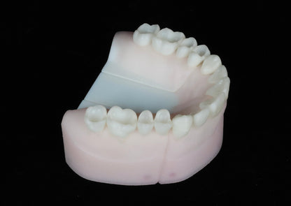 Class One Cavities Set