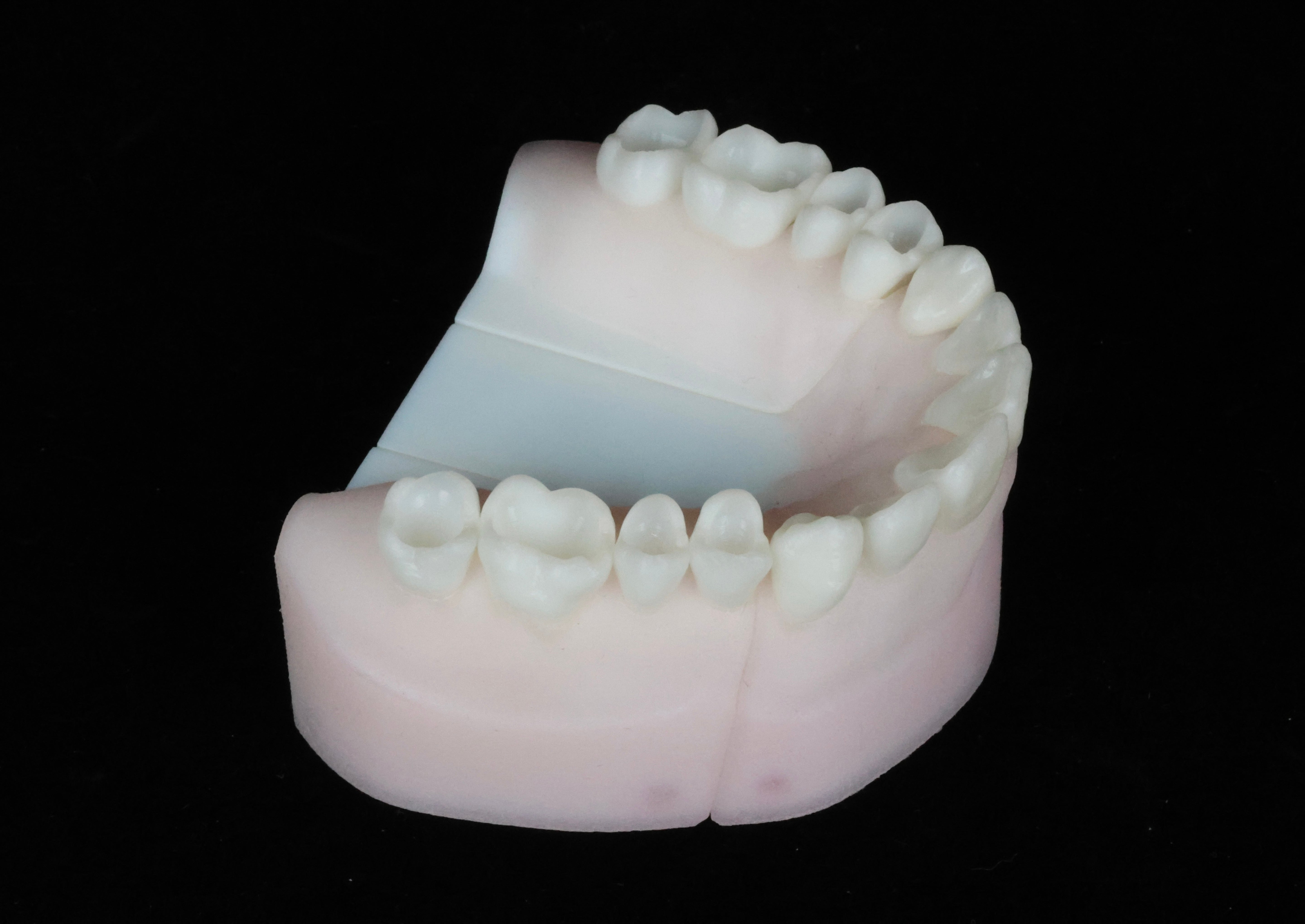 Class One Cavities Set
