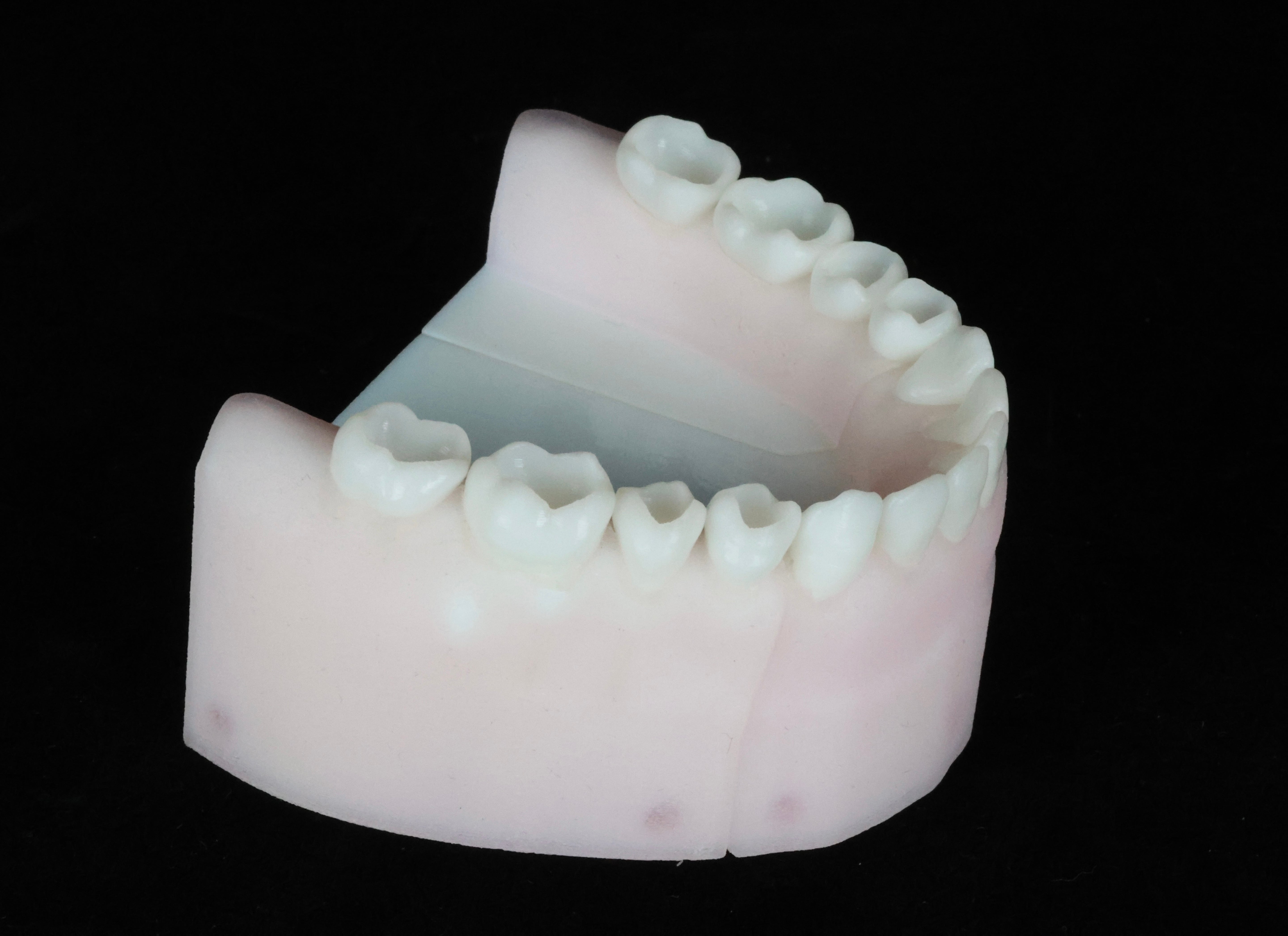 Class One Cavities Set