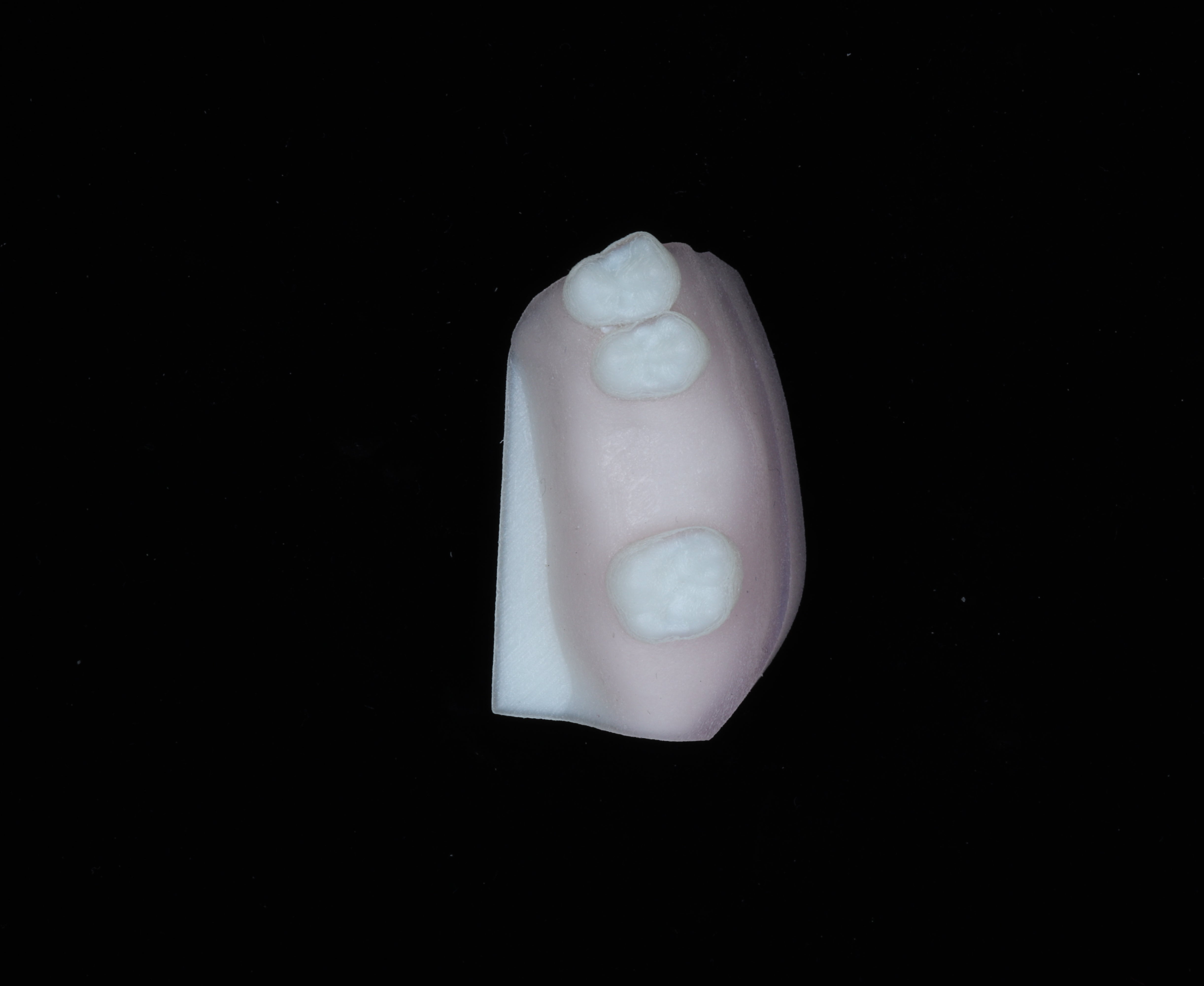 Implant Training Module